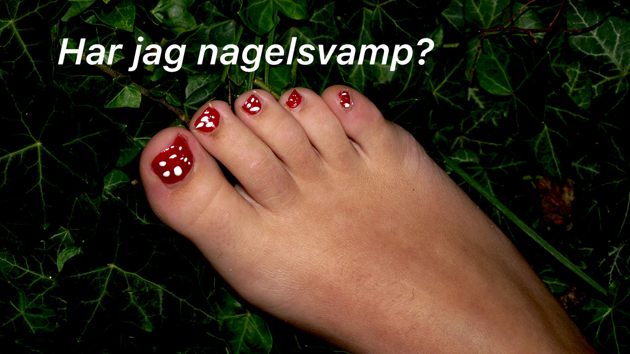 Pesamica - Har jag fotsvamp?